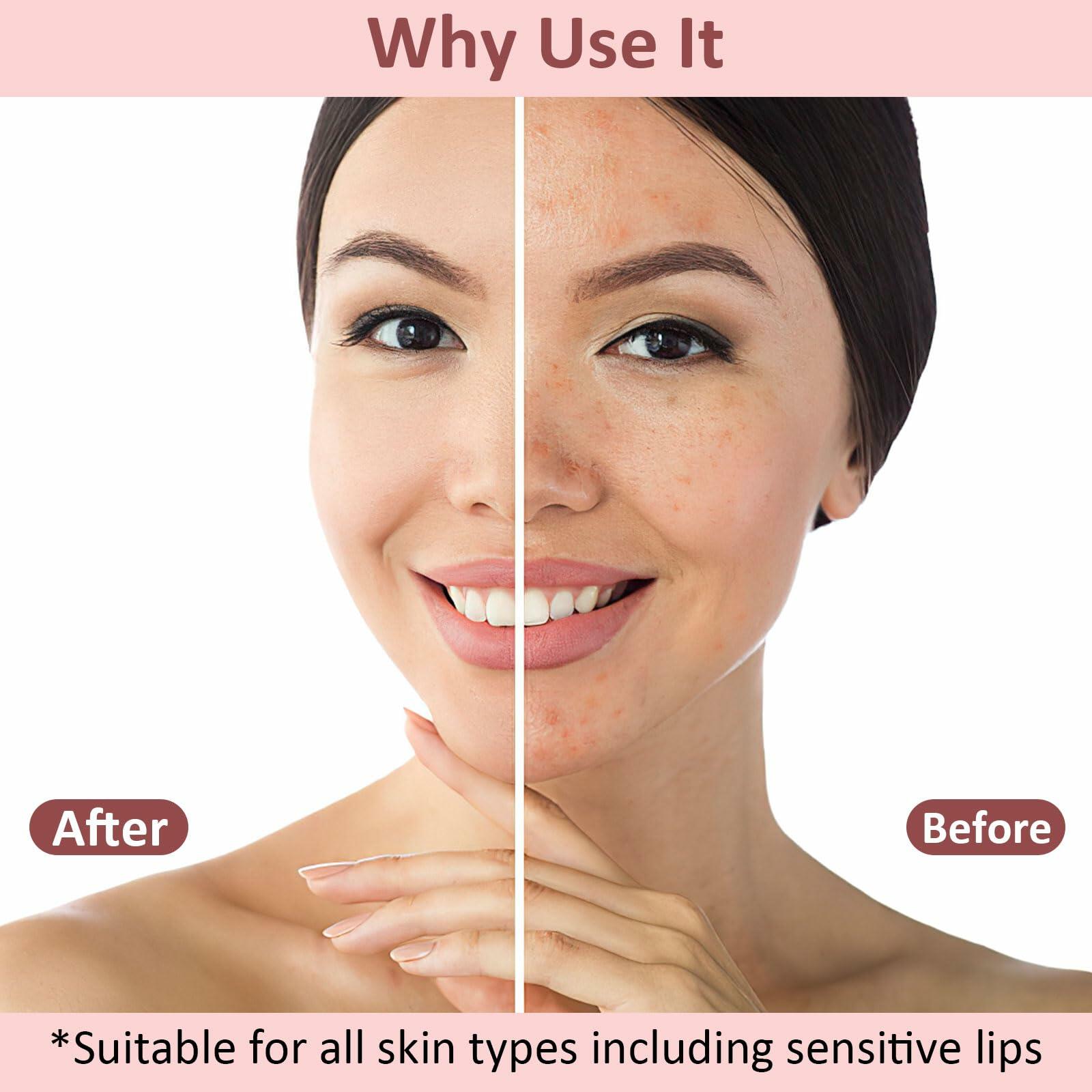 Lip scrubber set of 10